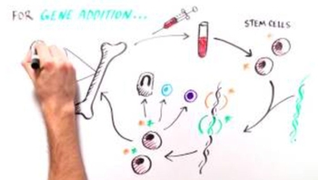 Bubble Baby Disease (SCID)