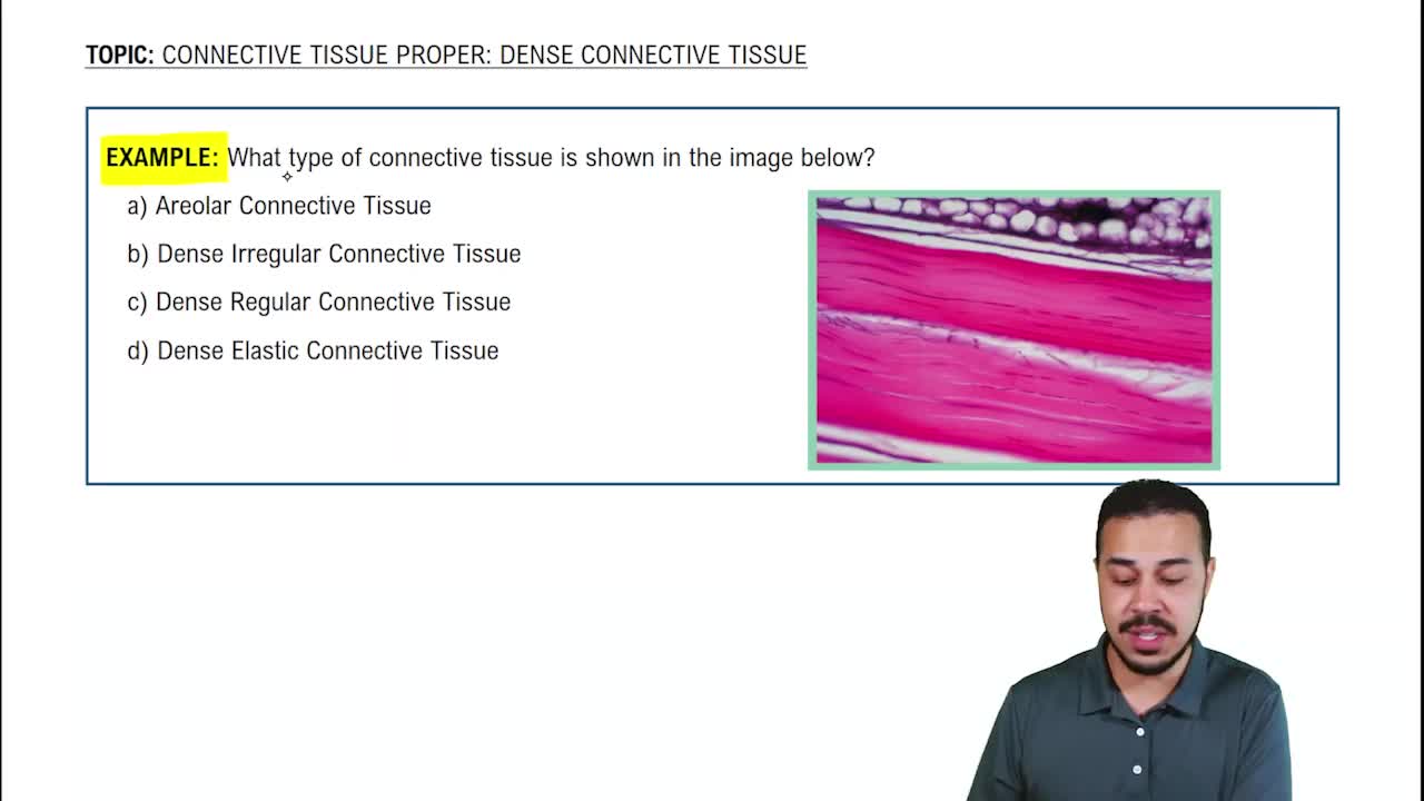 Connective Tissue Proper: Dense Connective Tissue Example 1