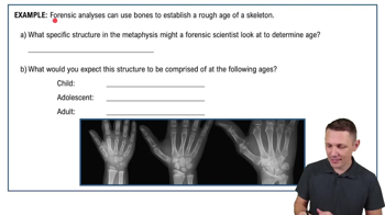 Gross Anatomy of Bones - Structure of a Long Bone Example 1