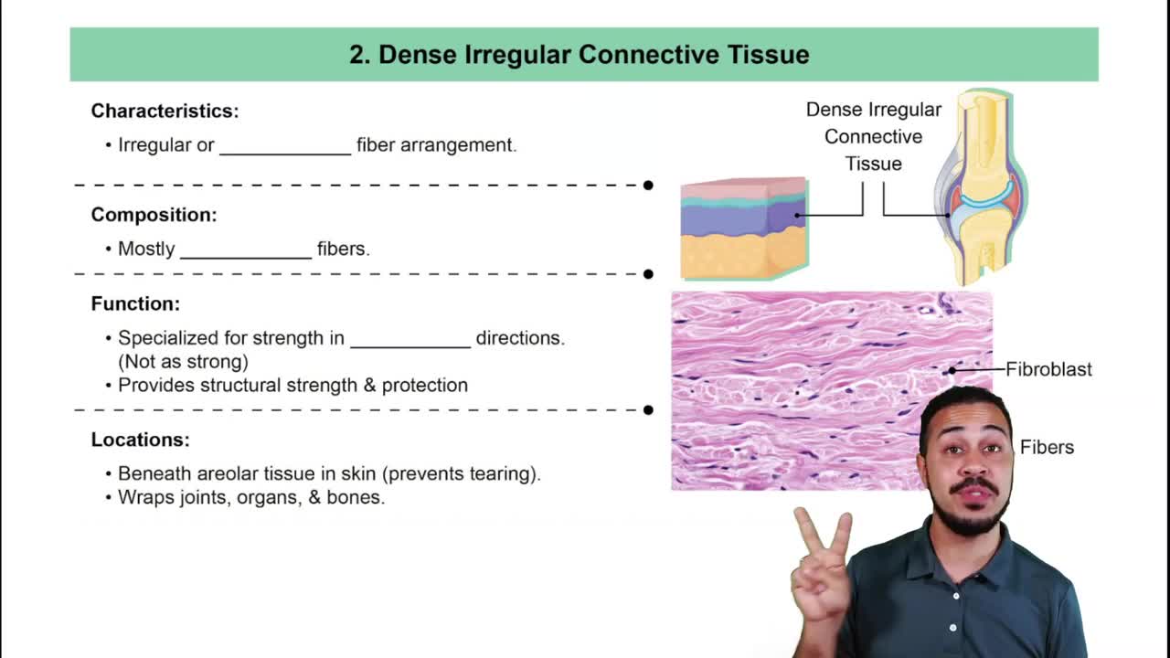 Dense Irregular Connective Tissue