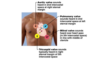 Auscultating Heart Sounds