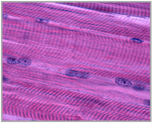 Microscopic view of striated skeletal muscle fibers with visible nuclei and banding patterns.