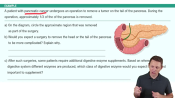 Pancreas Example 2