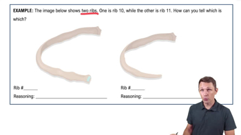 The Thoracic Cage Example 1