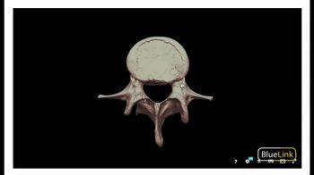 Anatomy of General Vertebrae