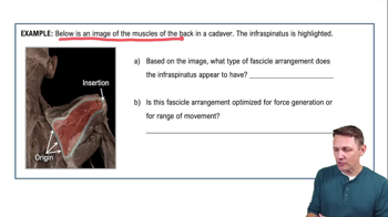 Fascicle Arrangements Example 1