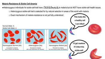 Sickle Cell Anemia