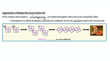 Sickle Cell Anemia