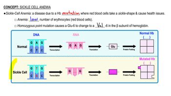 Sickle Cell Anemia