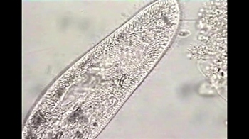 Short Video: Paramecium Vacuole