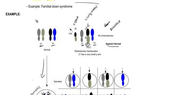 Robertsonian Translocations