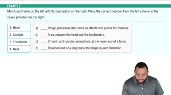 Bone Projections Example 1