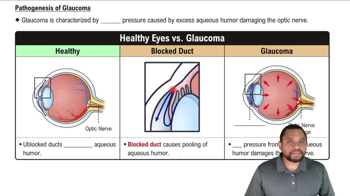 Pathogenesis of Glaucoma Concept 3