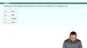 Bone Depressions Example 3