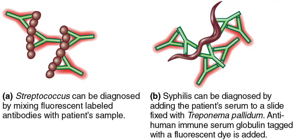 Diagram showing fluorescent antibody binding to bacteria: (a) labeled antibodies bind Streptococcus, (b) patient serum binds Treponema.