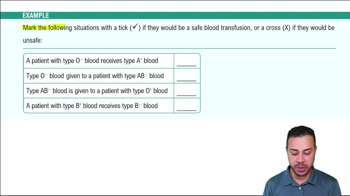 Type II Hypersensitivities Example 2