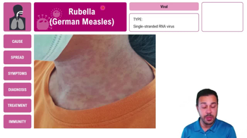 Rubella