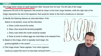 Helminthic Diseases of the Digestive System Example 1
