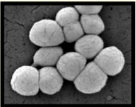 Clustered spherical bacterial cells shown under a microscope illustrating cell morphology and arrangement.
