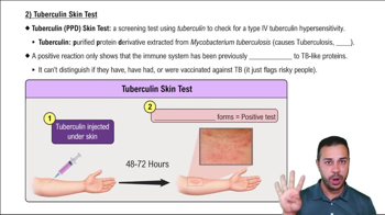 2) Tuberculin Skin Test