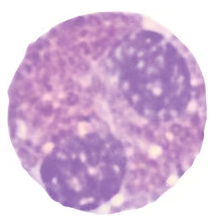 Microscopic image of a granulocyte showing multi-lobed nucleus and granular cytoplasm.