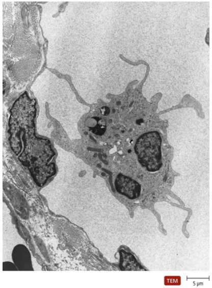 Transmission electron micrograph of a dendritic cell showing labeled pseudopod, vesicle, and locations of MHCI and MHCII molecules.