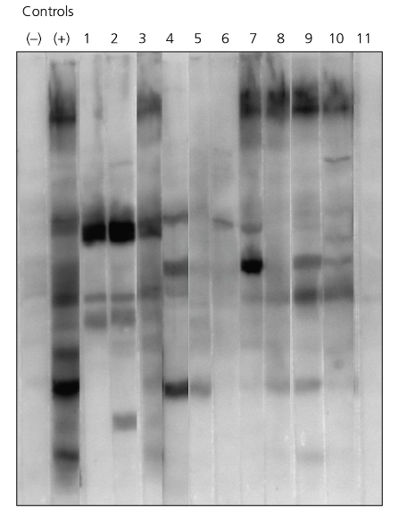 Immunoblot showing negative and positive controls and blots from 11 patients to identify likely uninfected individuals.