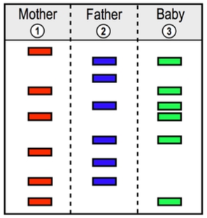 Gel electrophoresis results showing DNA bands for mother, father, and baby to determine biological relationship.