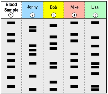 Gel electrophoresis results comparing blood samples from Jenny, Bob, Mike, and Lisa.