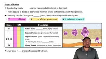 Stages of Cancer Concept 3