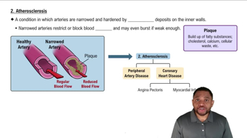 Atherosclerosis Concept 2