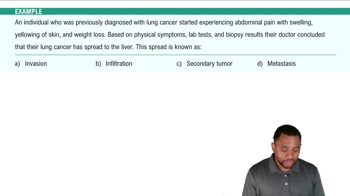 Metastasis: How Cancer Spreads Example 2