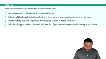 Atherosclerosis Example 2