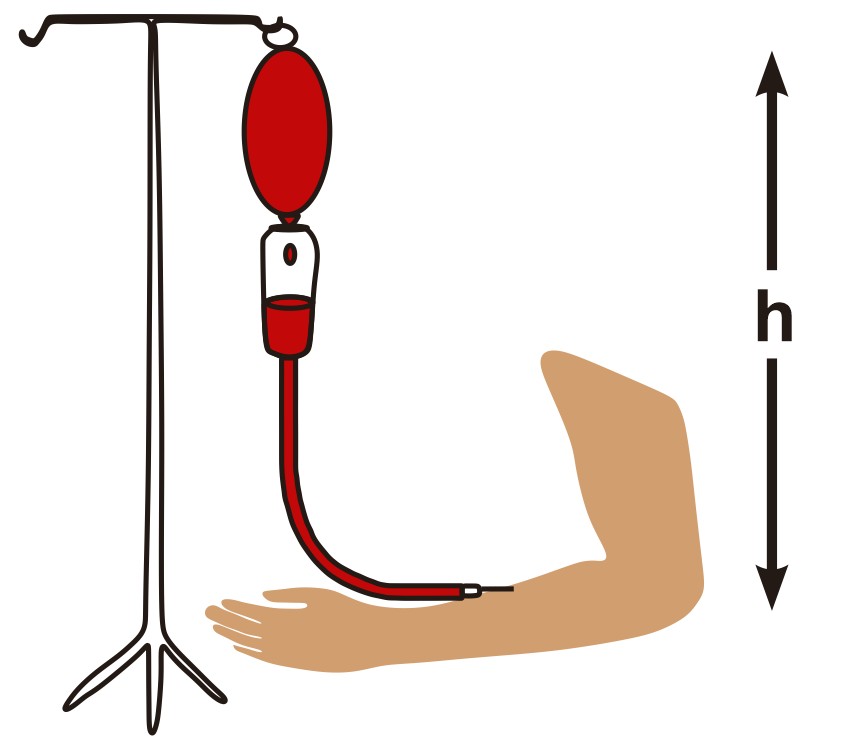 Illustration of an IV drip setup showing height 'h' for fluid flow into a patient's arm.