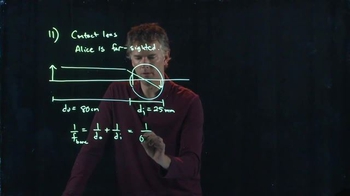 Anderson Video - Contact Lens Example