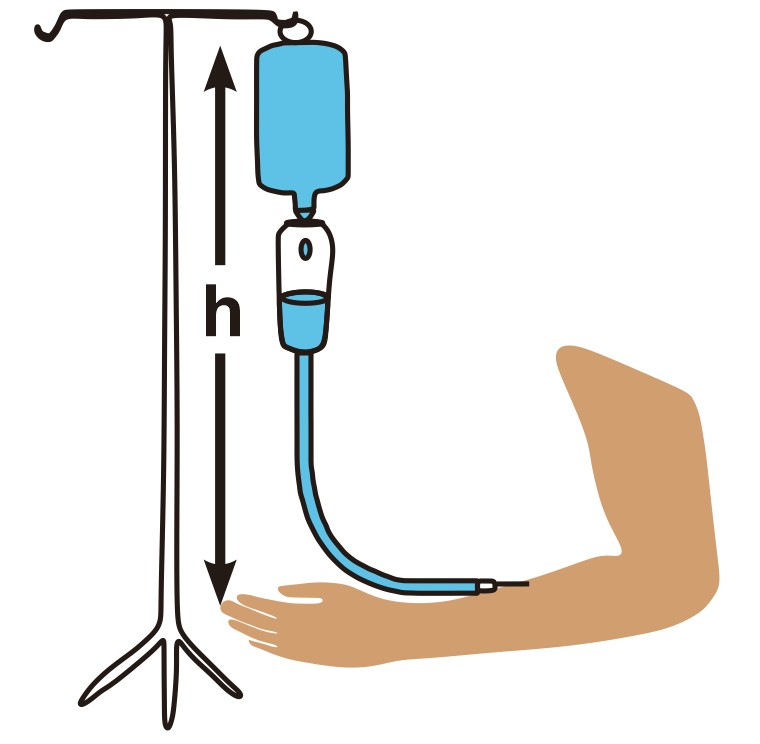 Diagram showing an IV setup with a saline bottle and arm, illustrating height for desired pressure.