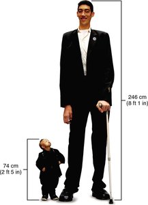 Comparison of gigantism and dwarfism