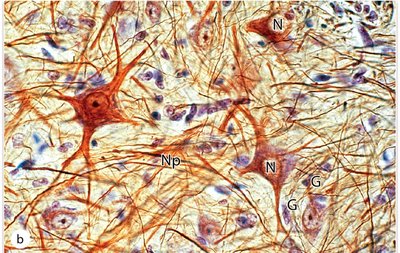 Histology section of the brain showing neurons and glial cells