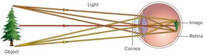 Image formation on the retina