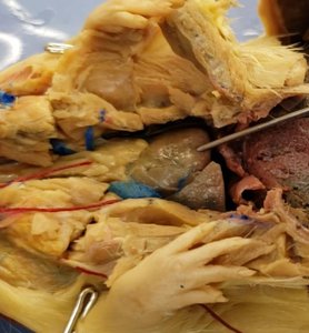 Rat dissection showing abdominal cavity