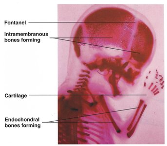 Microscopic view of bone cells during ossification