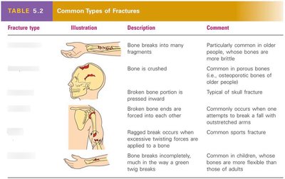 Table of common fracture types and comments