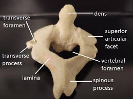 Short bone structure