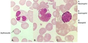 Blood smear showing granulocytes: neutrophil, eosinophil, basophil