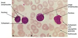 Blood smear showing agranulocytes: lymphocytes and monocytes
