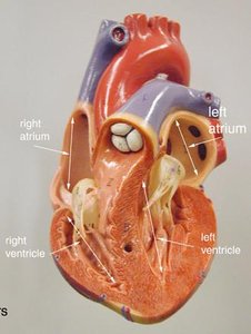 Transverse section showing differences in ventricular wall thickness