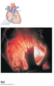 Heart valves with chordae tendineae and papillary muscles