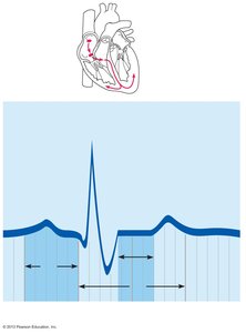 Electrocardiogram tracing