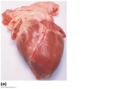 Anterior aspect of the heart, pericardium removed