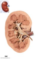 Kidney cross-section showing internal anatomy